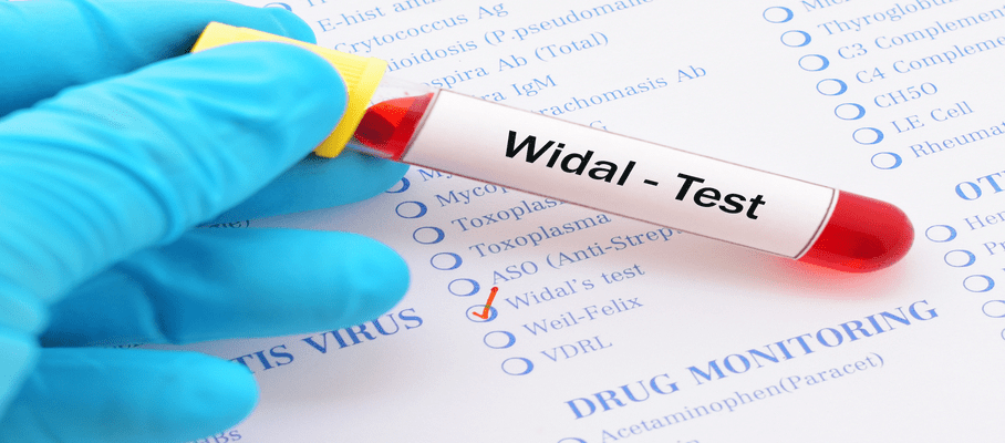 widal_test.png